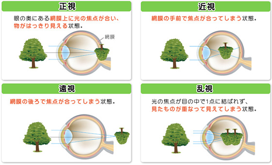 近視、遠視、乱視、老視、弱視、斜視の治療は所沢眼科クリニック